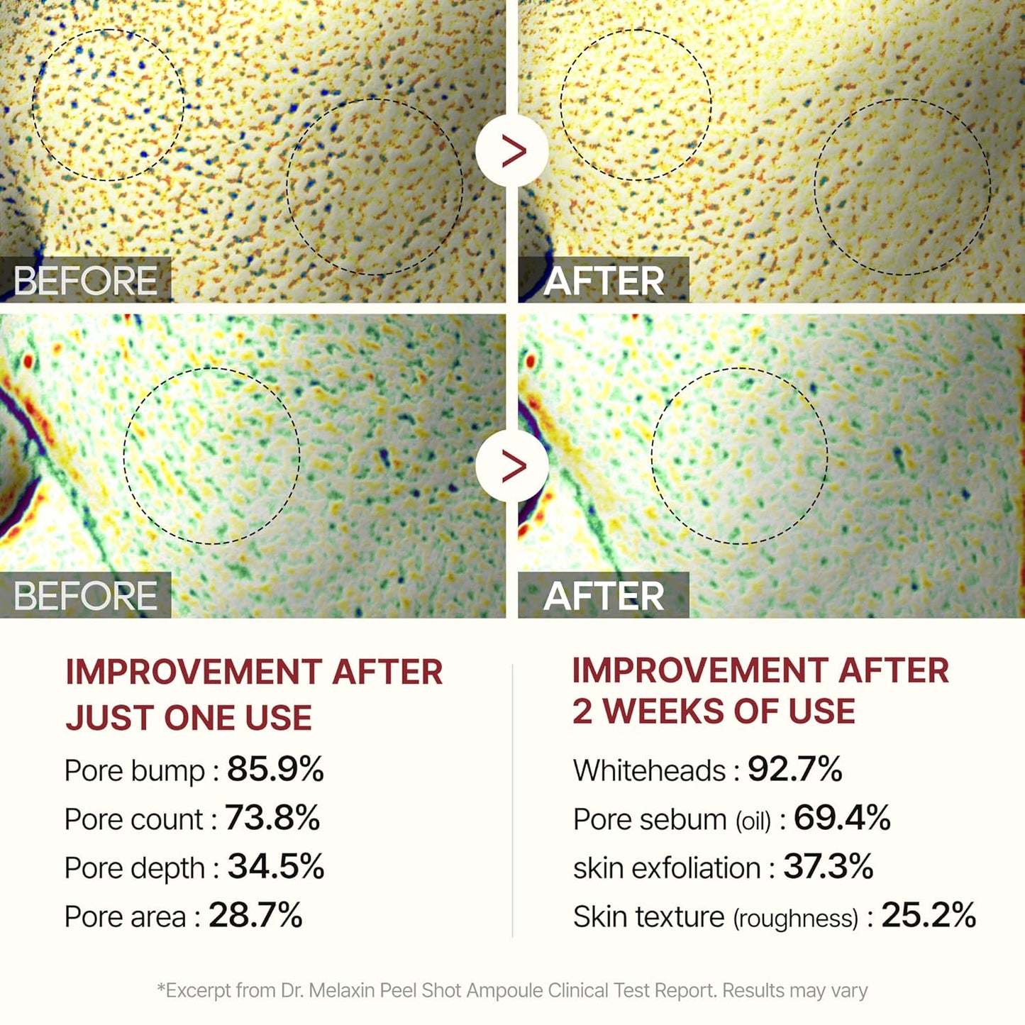 Dr. Melaxin Rice Peel Ampoule