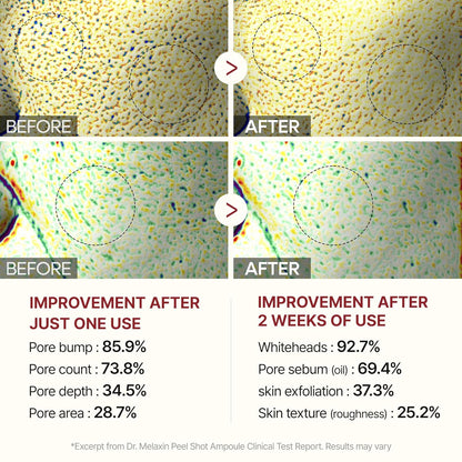 Dr. Melaxin Rice Peel Ampoule